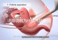 詳細(xì)說(shuō)明為什么凍胚要提前一兩天解凍，有沒(méi)有影響一目了然