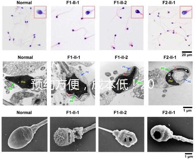 預約方便，成本低！2024年西安新城、臨潼、雁塔四維彩超指南