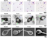 預約方便，成本低！2024年西安新城、臨潼、雁塔四維彩超指南