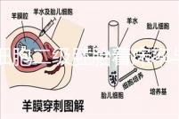 6細(xì)胞二級(jí)胚胎著床率與養(yǎng)囊成功率解讀,拿不準(zhǔn)移植與否戳