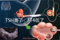 TSH高了,F(xiàn)T4低了,需要補(bǔ)碘嗎?