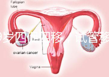 39歲四促四移,試管移植失敗5次后應(yīng)該怎么辦?