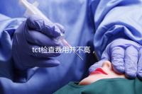 tct檢查費用并不高，不同醫院收費標準不一樣